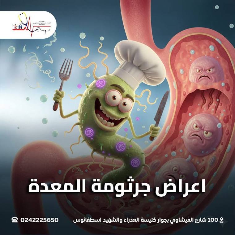 مركز سان چورچ — خشونة الركبة